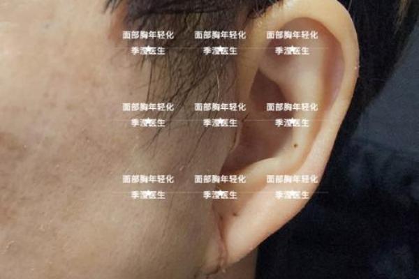 耳垂长白毛背后隐藏的命运密码,你知道吗? 耳垂长白毛背后隐藏的命运密码,你知道吗?