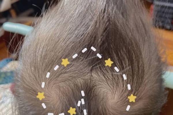 如何改变头顶双旋命理 颠覆你对命运的认知