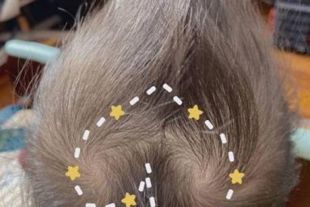 如何改变头顶双旋命理 颠覆你对命运的认知